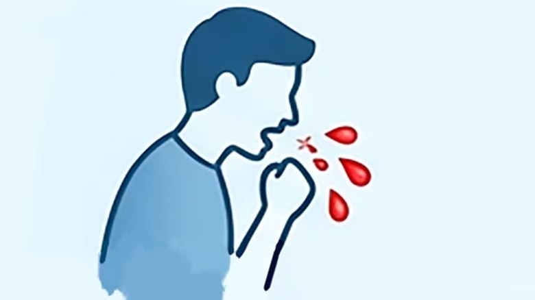 কাশির সঙ্গে রক্ত গেলে করণীয়