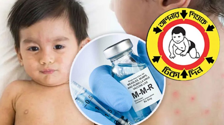 সারা দেশে আতঙ্ক ছড়াচ্ছে হাম, শিশুকে সুরক্ষিত রাখবেন যেভাবে