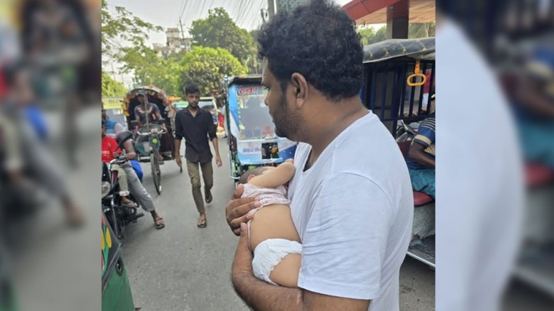 হাম আক্রান্ত ছেলেকে নিয়ে বাবার ‘আতঙ্কের স্ট্যাটাস’