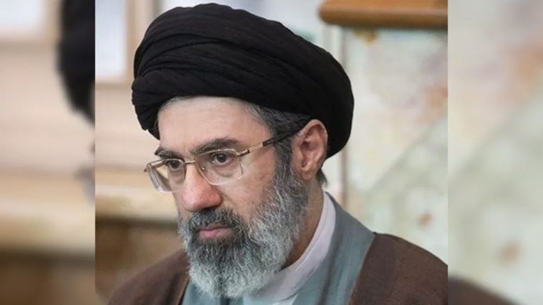 কৃত্রিম পা ও প্লাস্টিক সার্জারি করা হতে পারে মোজতবা খামেনির