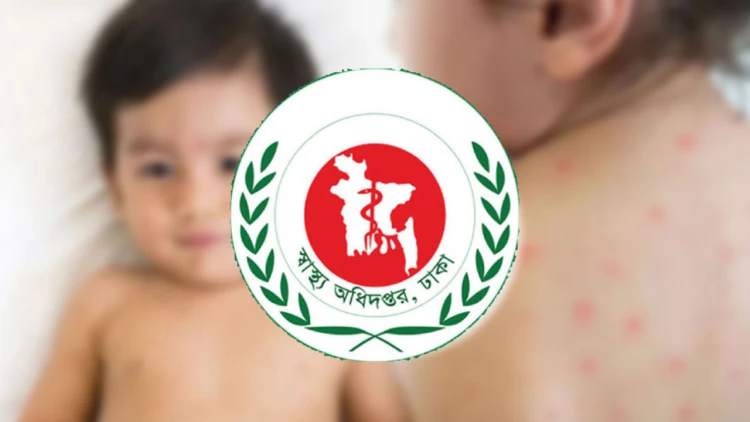 দেশে হাম ও উপসর্গে আরও ৯ শিশুর মৃত্যু