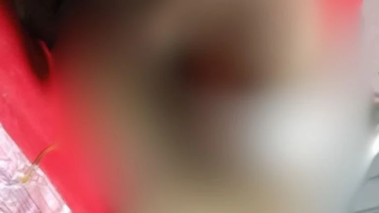 বগুড়ায় দুর্বৃত্তদের গুলিতে যুবক আহত