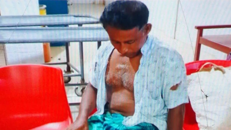 তানোরে জমি নিয়ে বিরোধে হাতুড়িপিটায় কৃষকের পা ভেঙে দিল প্রতিপক্ষ