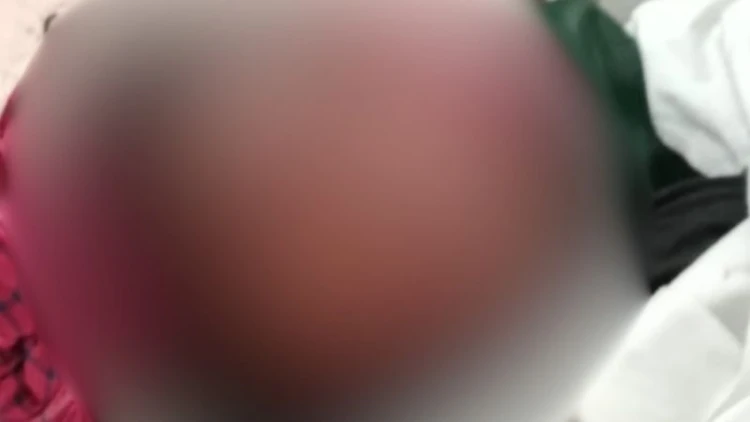 সদরপুরে অটোরিকশা-মোটরসাইকেল সংঘর্ষে কিশোর নিহত