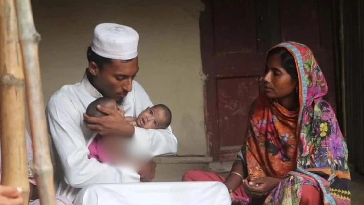 কুষ্টিয়ার জোড়া লাগা দুই শিশুর চিকিৎসার দায়িত্ব নিল সরকার