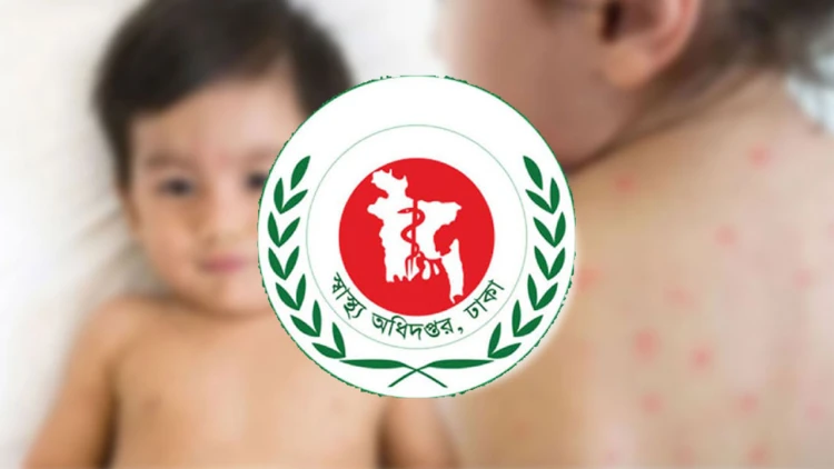 দেশে ১৫ মার্চ থেকে হাম ও হাম উপসর্গে মৃত্যু ১২২২