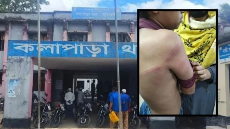 স্কুল শিক্ষকের পিটুনিতে হাসপাতালে ভর্তি ষষ্ঠ শ্রেণির শিক্ষার্থী